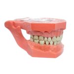 TIPODONTO ADULTO. WENCES