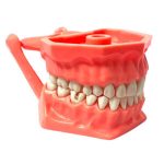 TIPODONTO C/CAVIDADES ADULTO. ADYSA