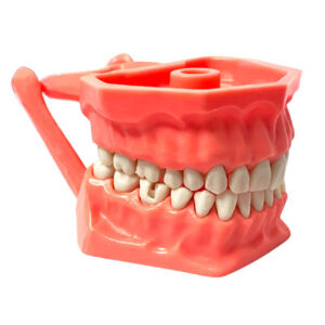 TIPODONTO C/CAVIDADES ADULTO. ADYSA