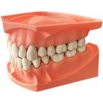 TIPODONTO EXTRA-GRANDE SIN BISAGRAS.